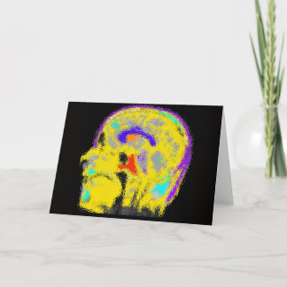 Mark's colourized MRI Card