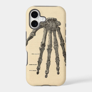 Medical Anatomy Hand Bones iPhone Case