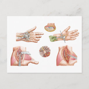 Medical Illustration Showing Carpal Tunnel Postcard