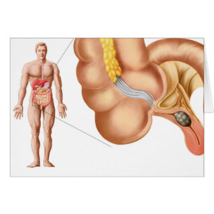 Medical Ilustration Of An Appendix