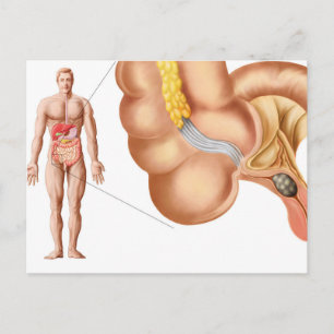 Medical Ilustration Of An Appendix Postcard
