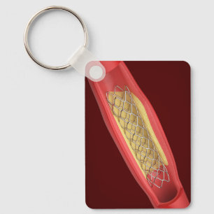 Medical stent inside blood vessel key ring
