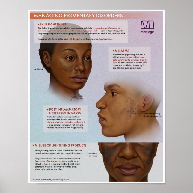 Melalogic Skin Lightening Medical Poster (Front)