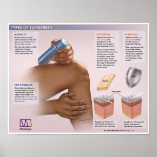Melalogic The Importance Of Sunscreen Medical Post Poster