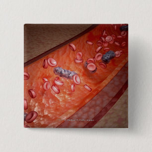 Microscopic rendering of a blood infection 15 cm square badge