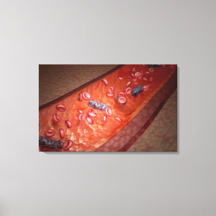 Microscopic rendering of a blood infection canvas print