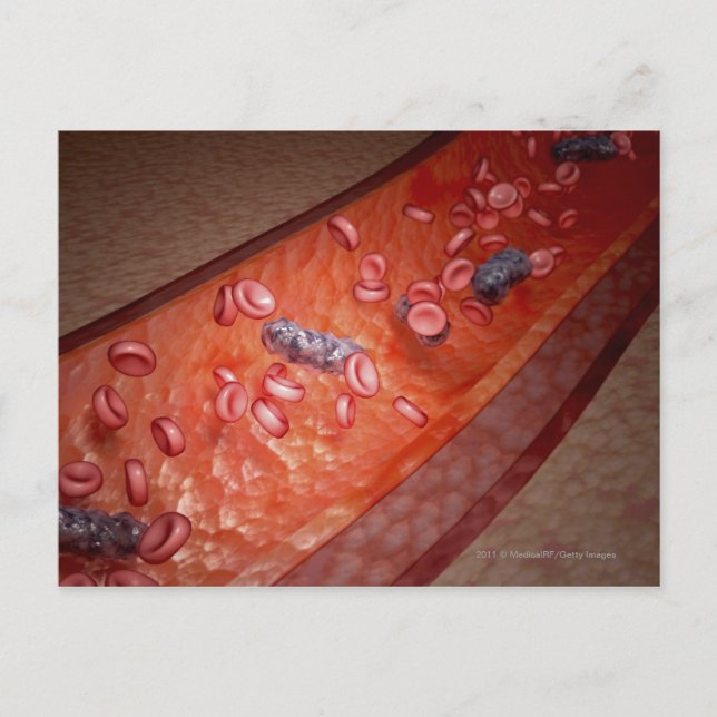 Microscopic rendering of a blood infection postcard (Front)