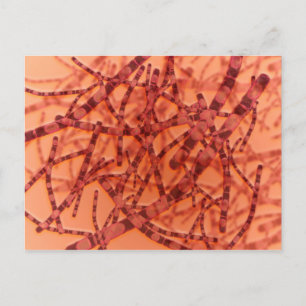 Microscopic View Of Anthrax 3 Postcard