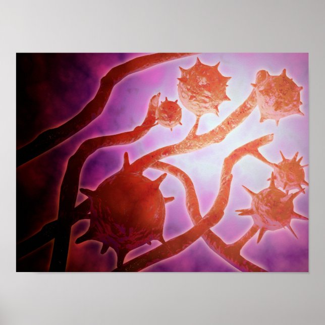 Microscopic View Of Histoplasmosis Poster (Front)