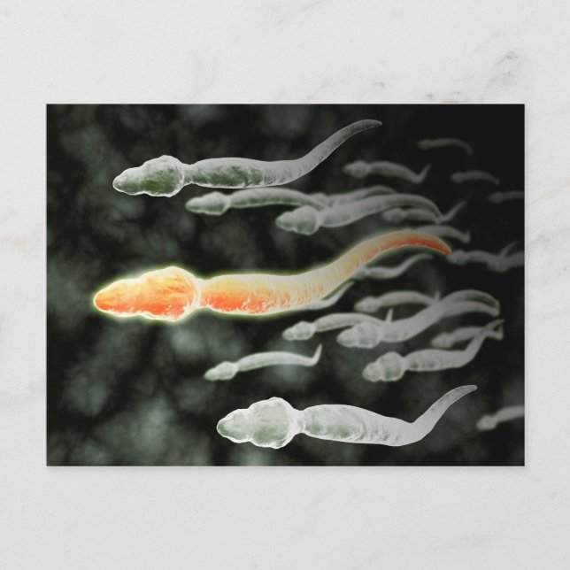 Microscopic View Of Sperm Travelling Postcard (Front)