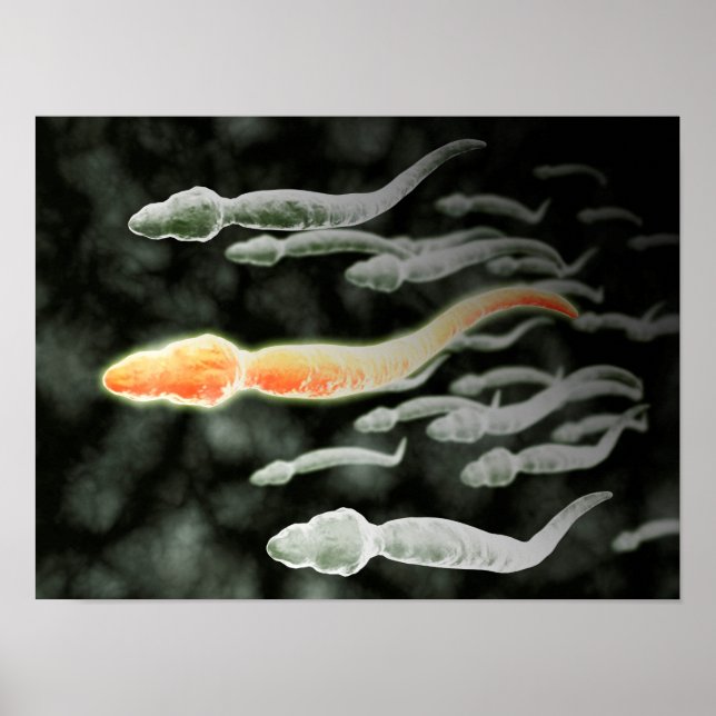 Microscopic View Of Sperm Travelling Poster (Front)