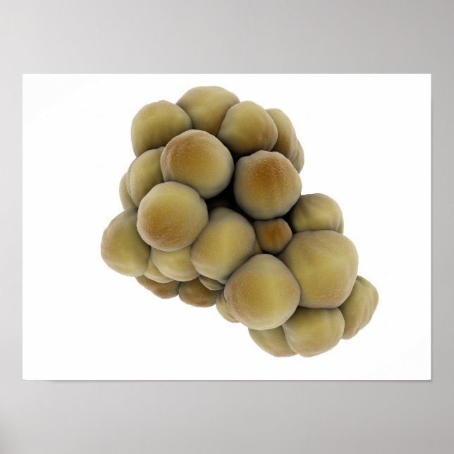 Microscopic View Of Tumor 5 Poster (Front)