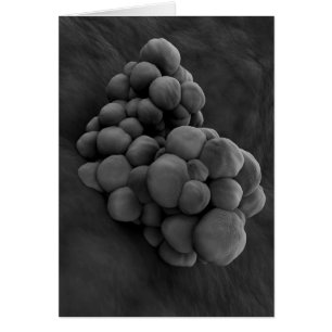 Microscopic View Of Tumour 1