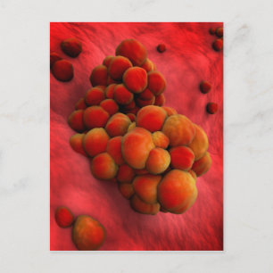 Microscopic View Of Tumour 2 Postcard
