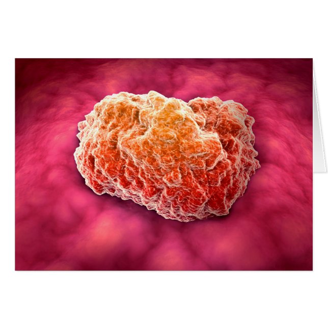 Microscopic View Of Tumour 3 (Front Horizontal)