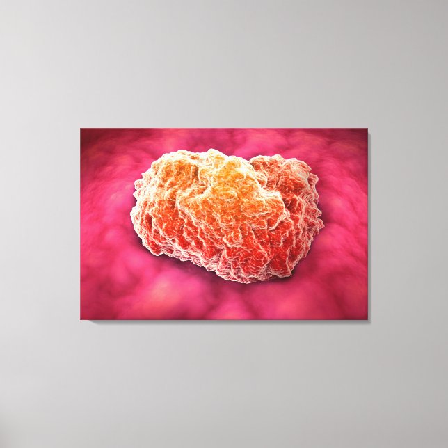 Microscopic View Of Tumour 3 Canvas Print (Front)