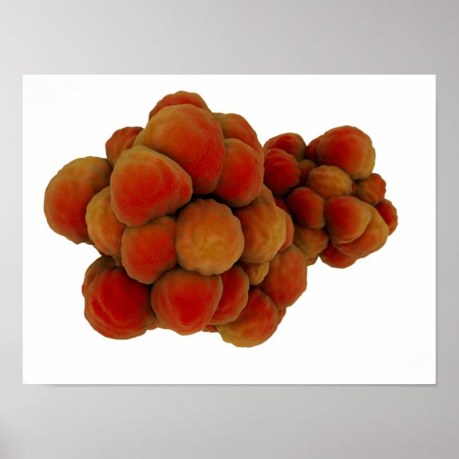 Microscopic View Of Tumour 4 Poster (Front)