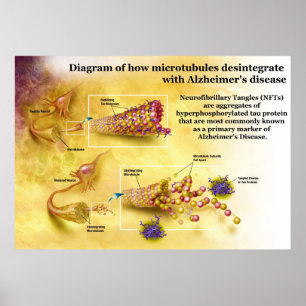 Microtubules Desintegration in Alzheimer's Disease Poster
