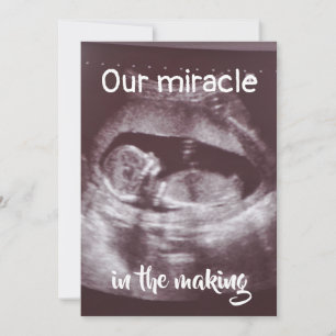 Miracle In Making Ultrasound 2 Photo Baby Family Announcement