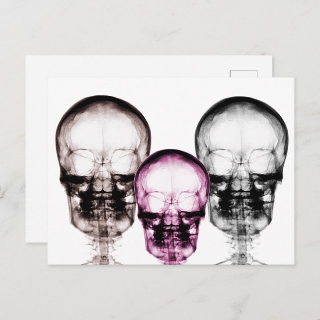 Mixed Colour X-Ray Vision Skeletons Skulls Postcard (Front/Back)