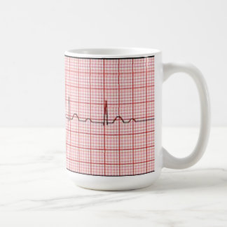 Mobitz 1 coffee mug