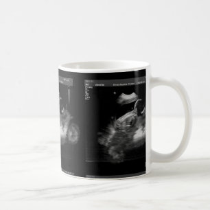 Motorcycle Sonogram Mug