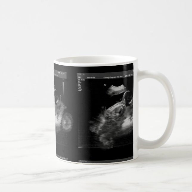 Motorcycle Sonogram Mug (Right)