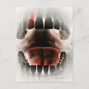 Mouth Postcard