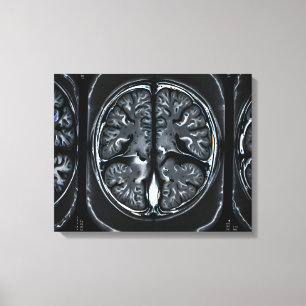 MRI brain scan Canvas Print