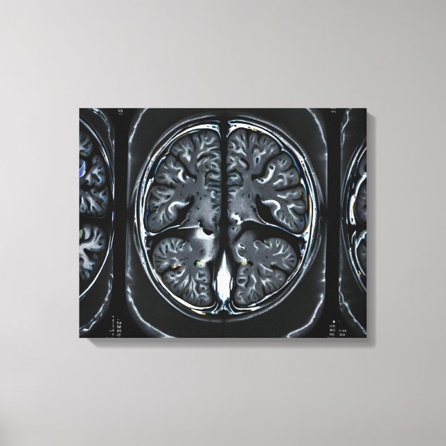 MRI brain scan Canvas Print (Front)