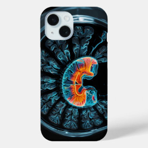 MRI brain scan iPhone 15 Case