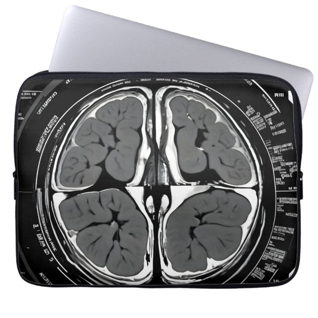 MRI brain scan Laptop Sleeve (Front)