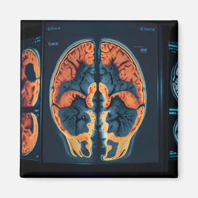MRI brain scan Magnet (Front)