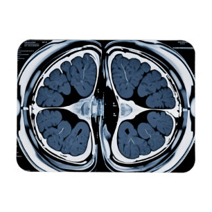 MRI brain scan Magnet