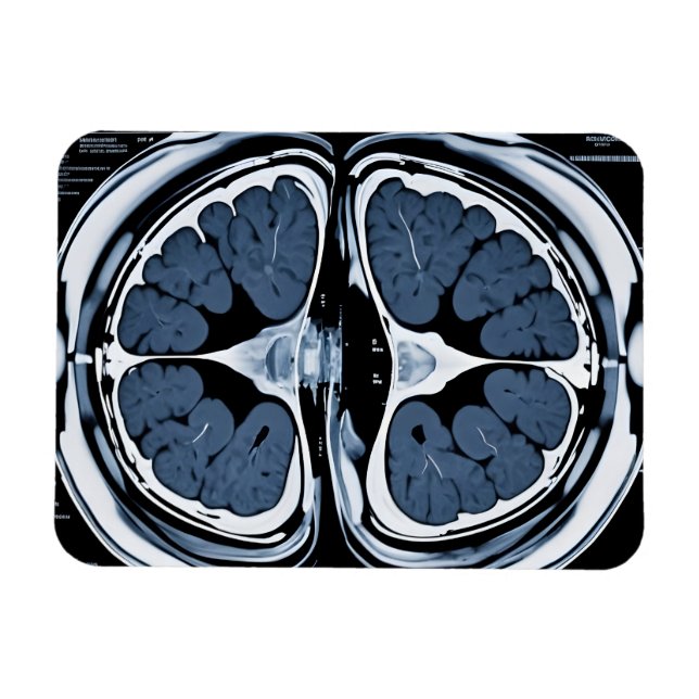 MRI brain scan Magnet (Horizontal)