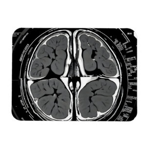 MRI brain scan Magnet