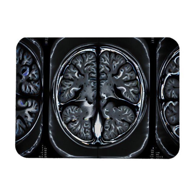 MRI brain scan Magnet (Horizontal)