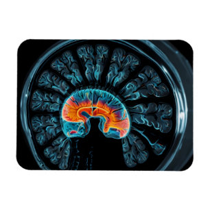 MRI brain scan Magnet