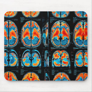 MRI brain scan Mouse Mat