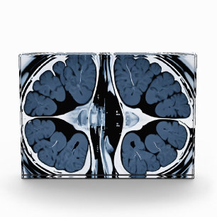 MRI brain scan Photo Block