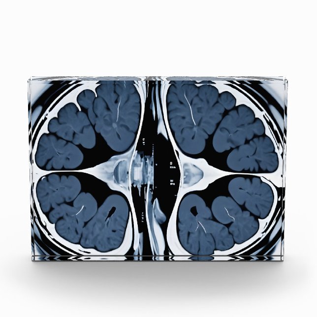 MRI brain scan Photo Block (Front)