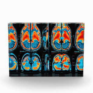 MRI brain scan Photo Block