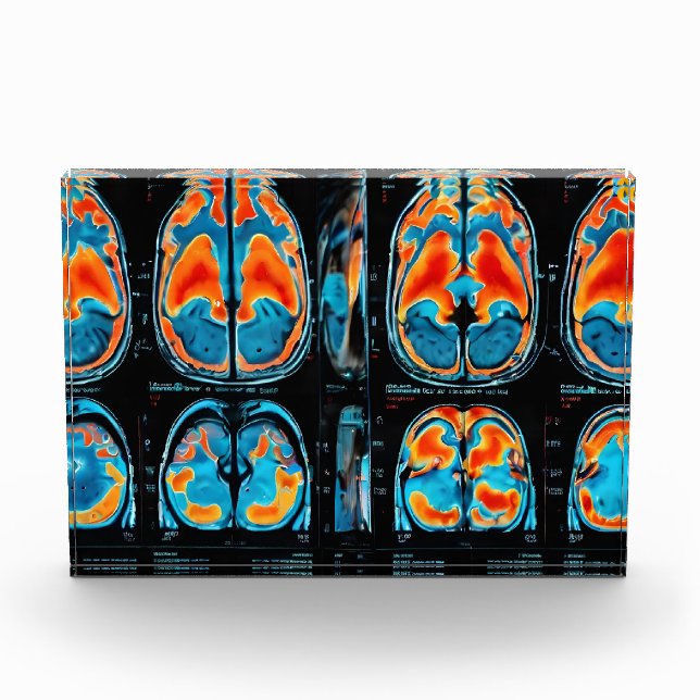 MRI brain scan Photo Block (Front)