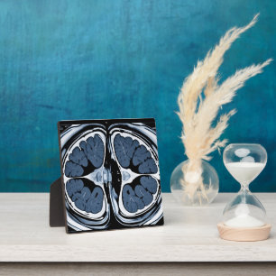 MRI brain scan Plaque