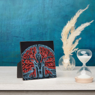 MRI brain scan Plaque