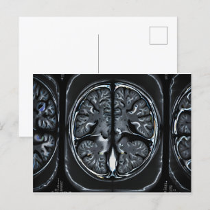 MRI brain scan Postcard
