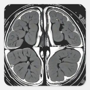 MRI brain scan Square Sticker