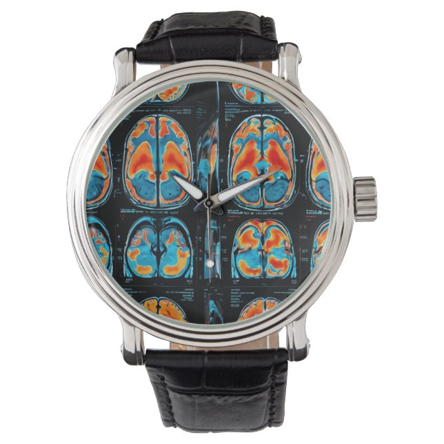 MRI brain scan Watch (Front)