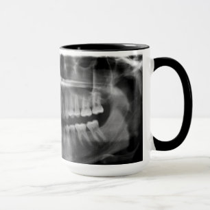 Mug X-ray Radiology