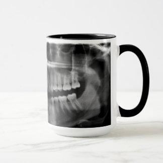 Mug X-ray Radiology